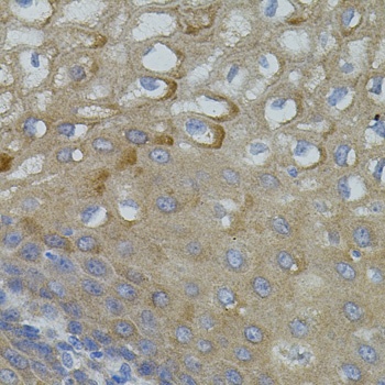 Mitofusin 2 Antibody