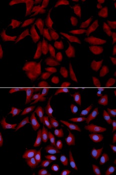 UBE2I Antibody