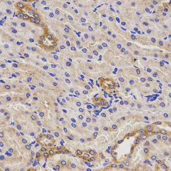 TNFRSF1B Antibody