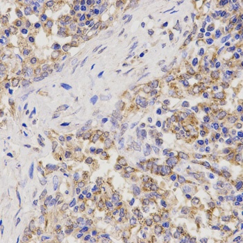 TNFRSF1B Antibody