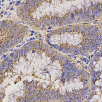 TNFRSF1B Antibody