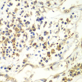 UPF1 Antibody