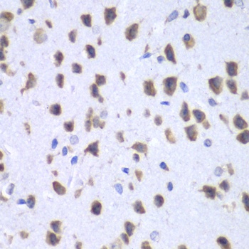 UPF1 Antibody