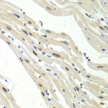 UPF1 Antibody