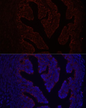 COL1A1 Antibody