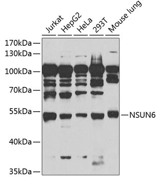 NSUN6 Antibody