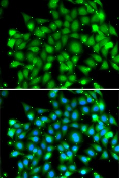 SUFU Antibody