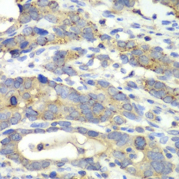 CHMP2B Antibody