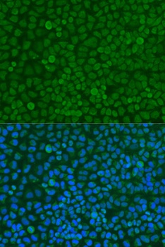 YWHAZ Antibody