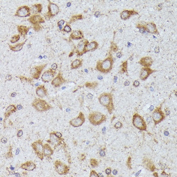 TBCB Antibody