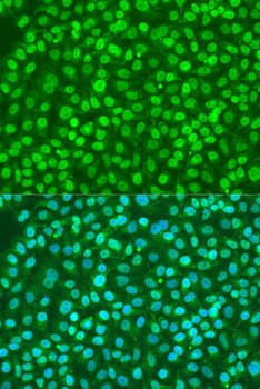 BDNF Antibody