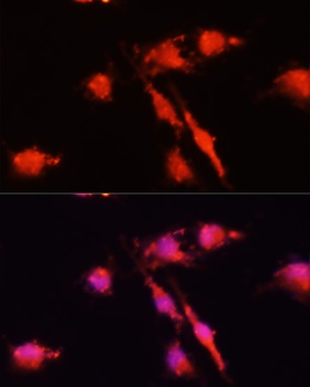 BDNF Antibody