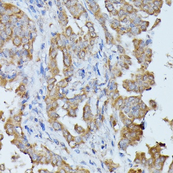 HAL Antibody