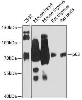 p63 Antibody