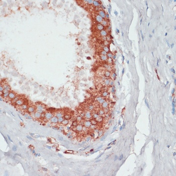 PGK2 Antibody