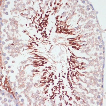 PGK2 Antibody