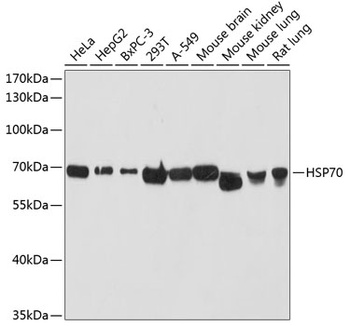 HSP70 Antibody