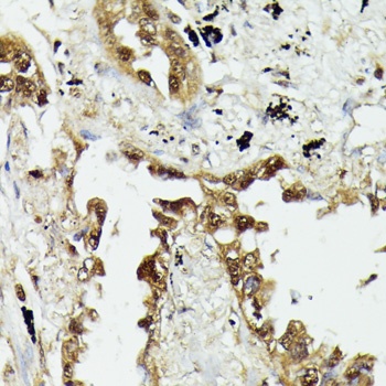 HSP70 Antibody