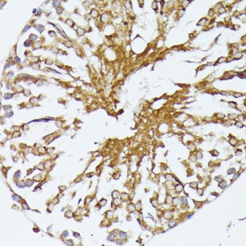 HSP70 Antibody