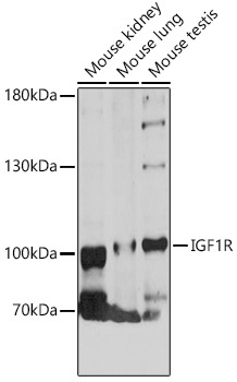 IGF1R Antibody