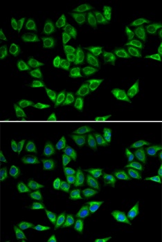 PRDX5 Antibody