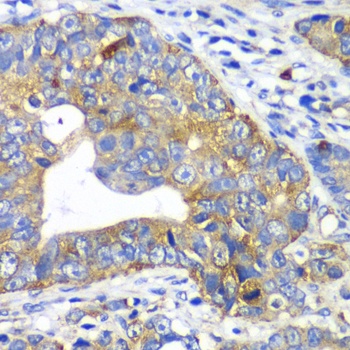 ARFGAP1 Antibody