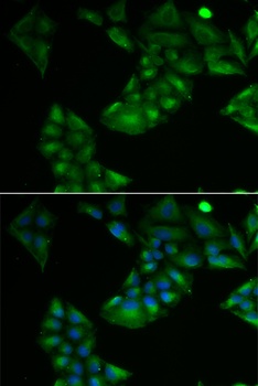 TXN2 Antibody