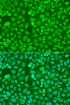 TIA1 Antibody