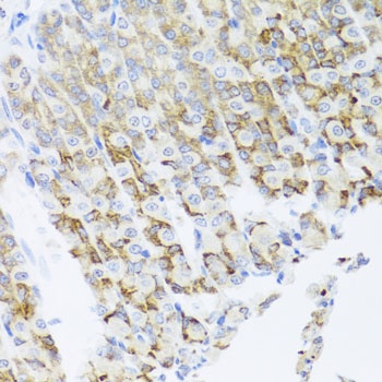 PIK3CA Antibody