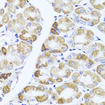 PIK3CA Antibody