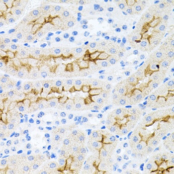 IL17A Antibody
