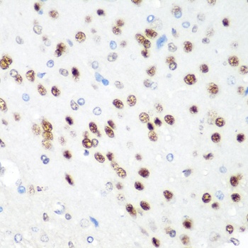 CDK1 Antibody