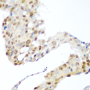 CDK1 Antibody