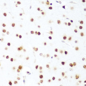 CDK1 Antibody