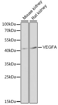 VEGF Antibody