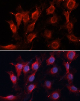 VEGF Antibody