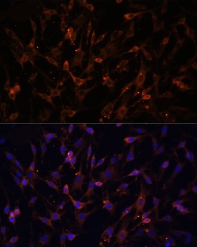 KRAS Antibody