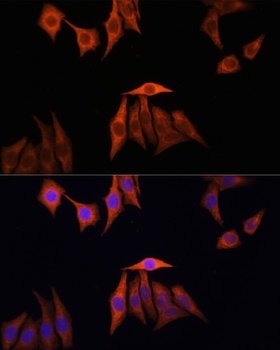 KRAS Antibody