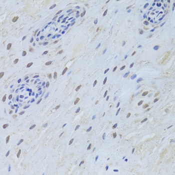 TARDBP Antibody