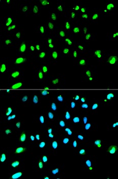 TARDBP Antibody