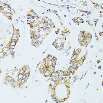 EGFR Antibody