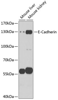 E-Cadherin Antibody