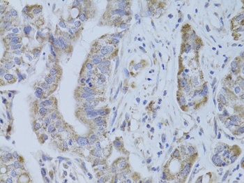 CDKN1A Antibody