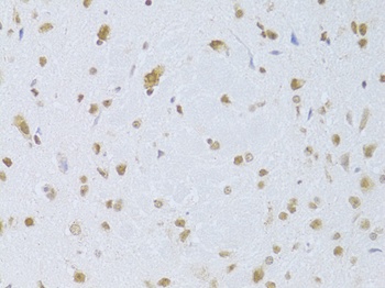 CDKN1A Antibody