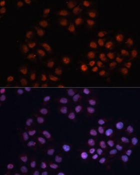 CDKN1A Antibody