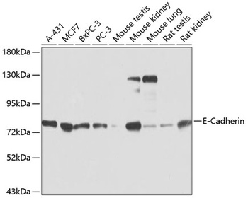 E-Cadherin Antibody