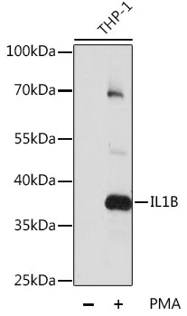 IL1B Antibody