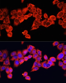IL1B Antibody