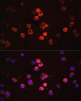 IL1B Antibody