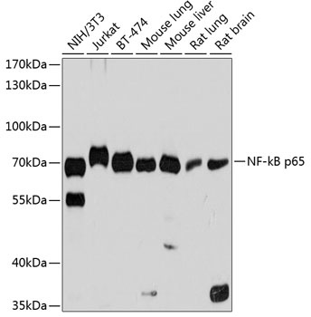 NF-kB p65 Antibody